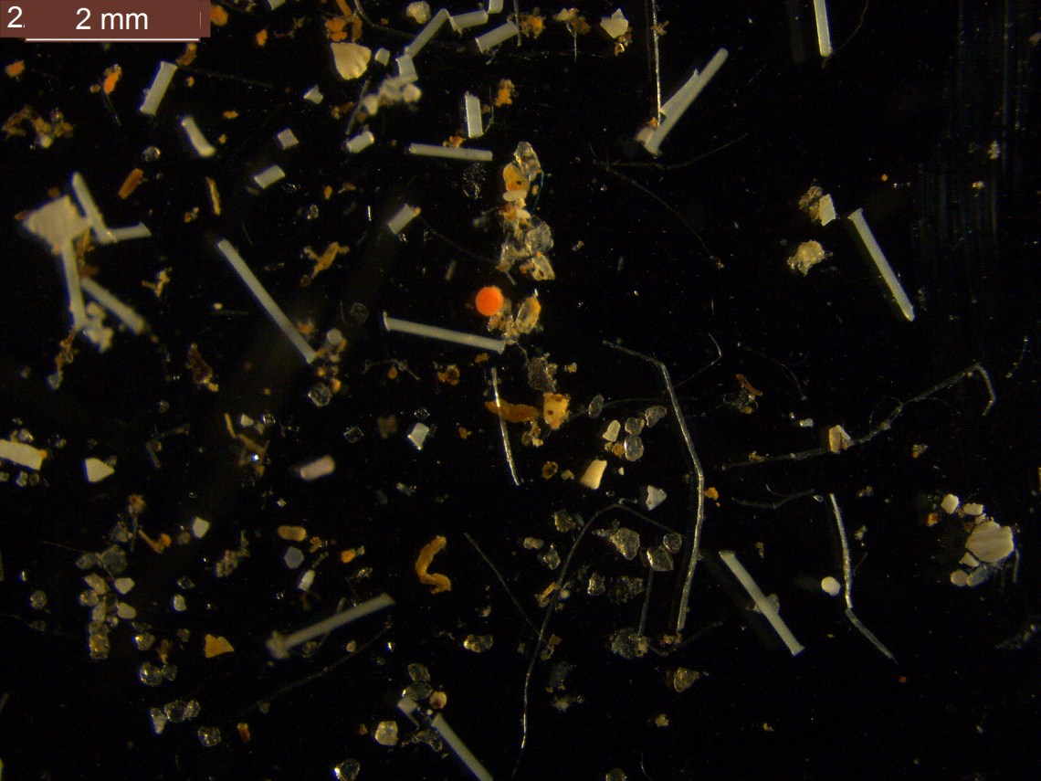 Microplastics_Black background